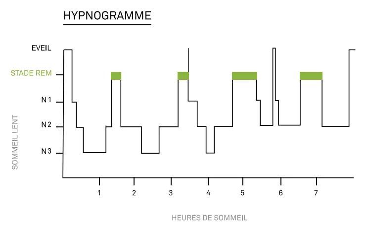 Hypnogramme